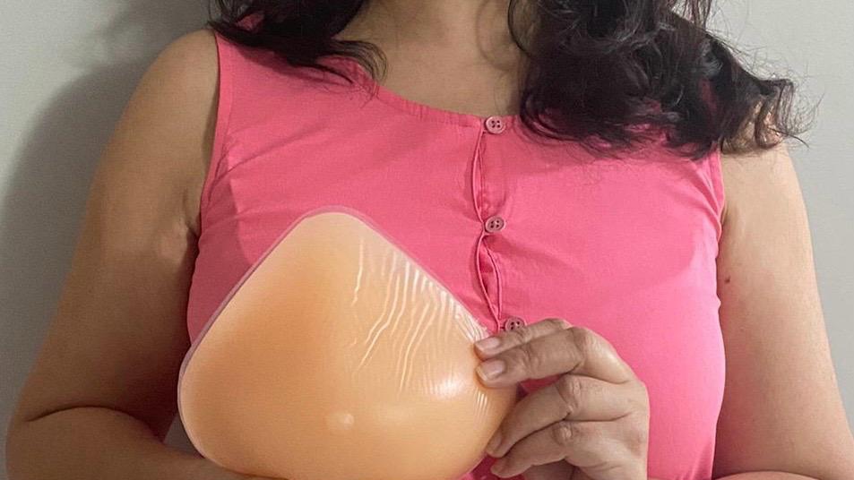 Role of REVIVA external breast prostheses in posture balance after a mastectomy